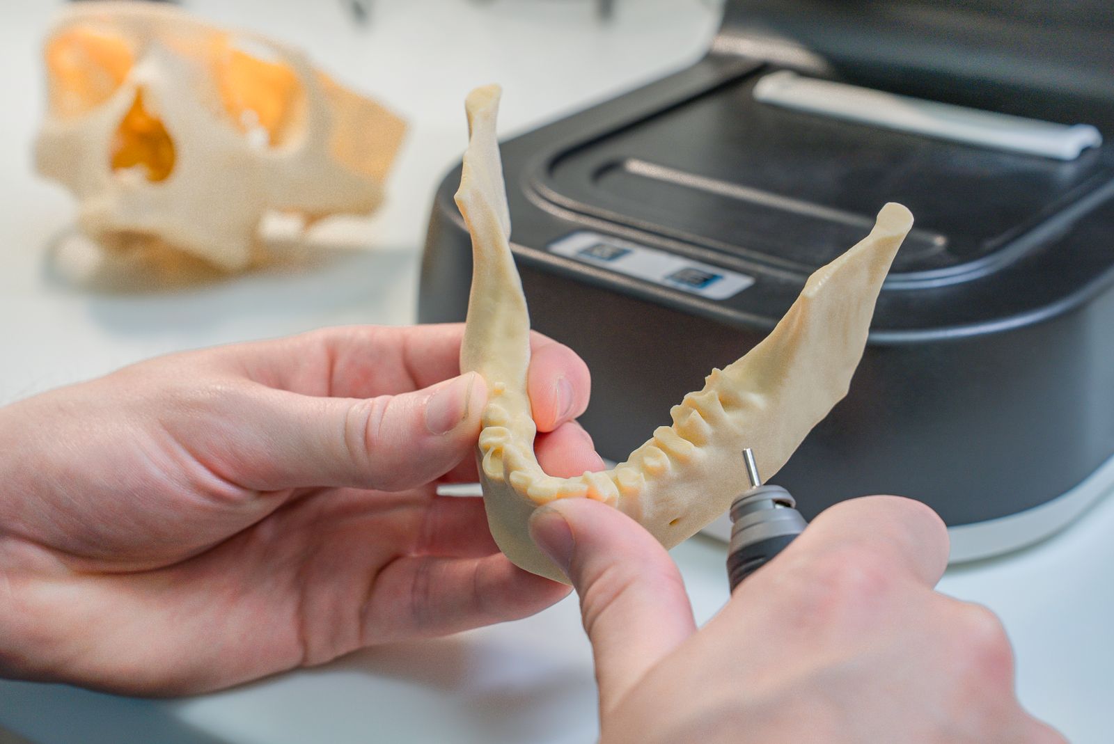 3D-gedrucktes Zahnmodell wird von einer Fachkraft im Praxislabor bearbeitet